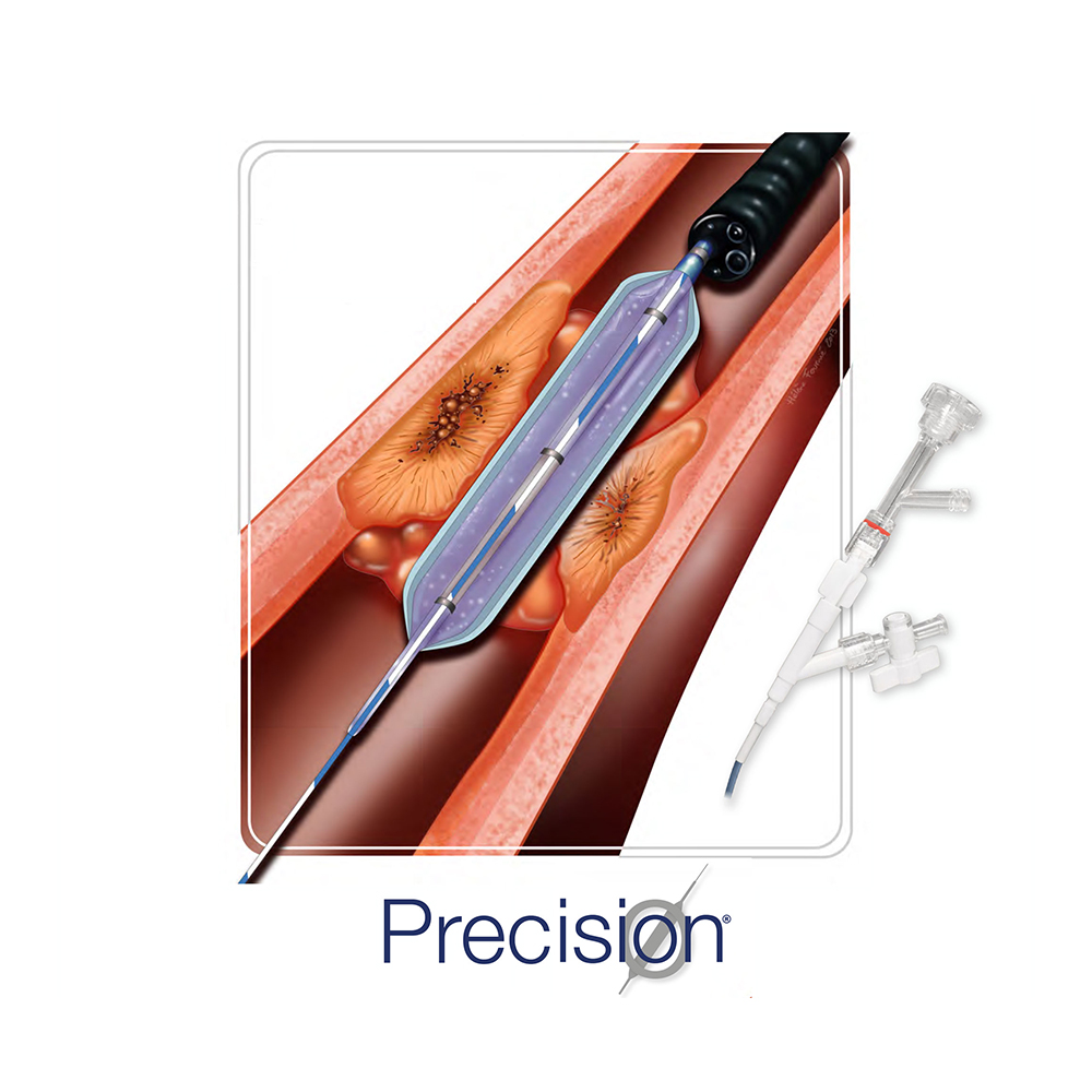 Progressive Dilation Balloon