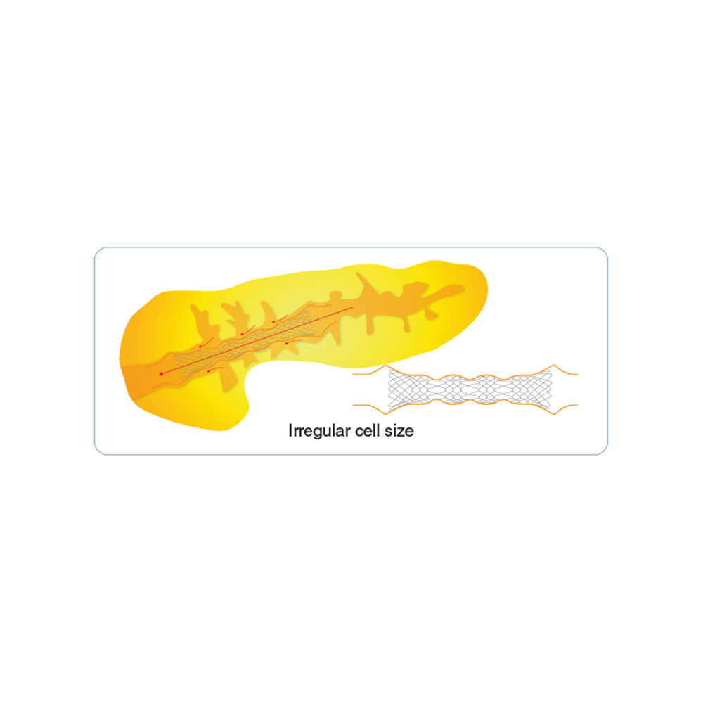 Niti-S Biliary Covered Stent [Bumpy]