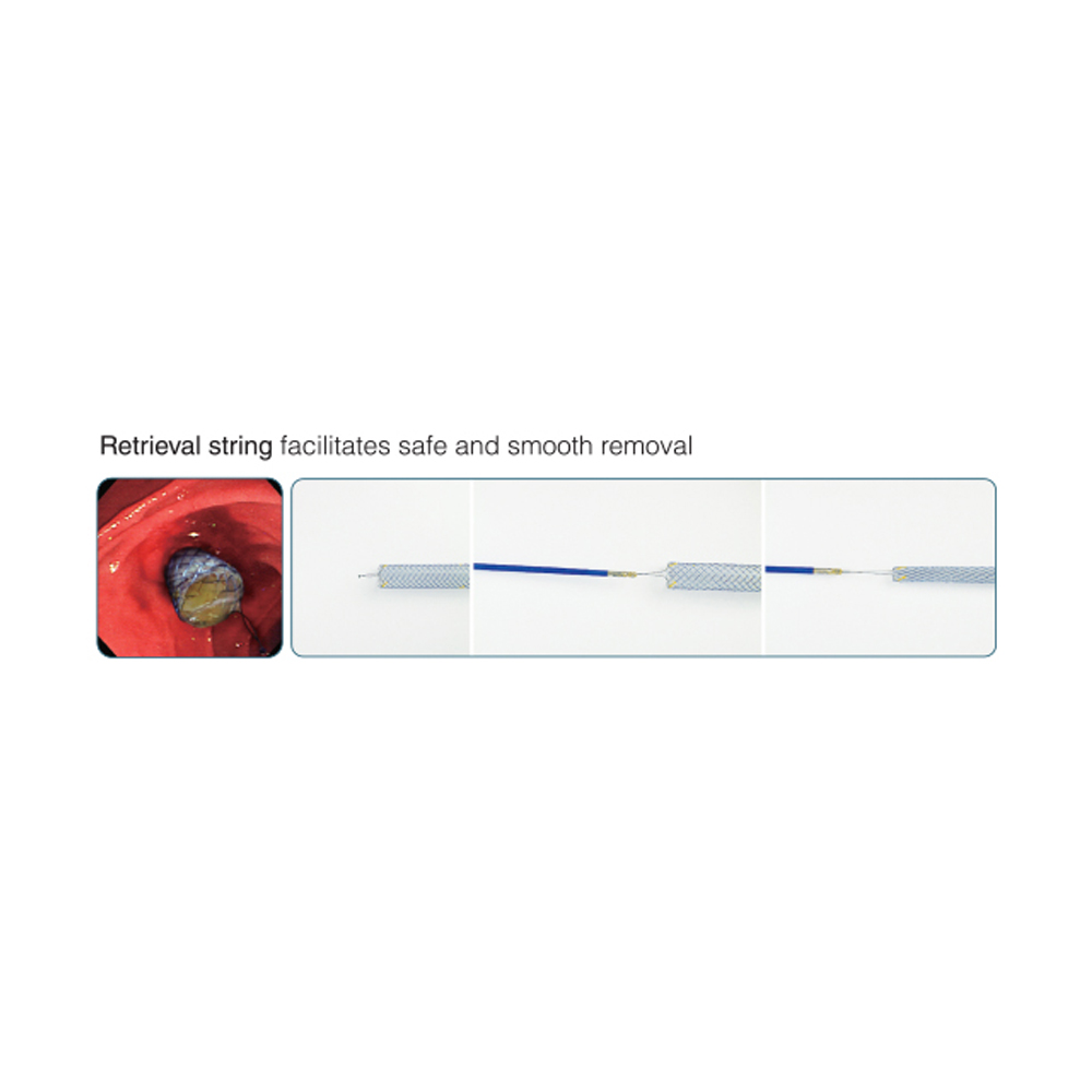Niti-S Biliary Covered Stent [S-Type / Both Bare-Type]