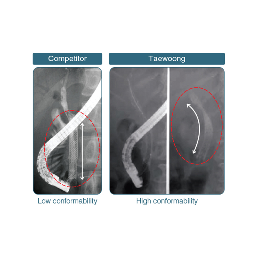 Niti-S Biliary Uncovered Stent [D-Type]