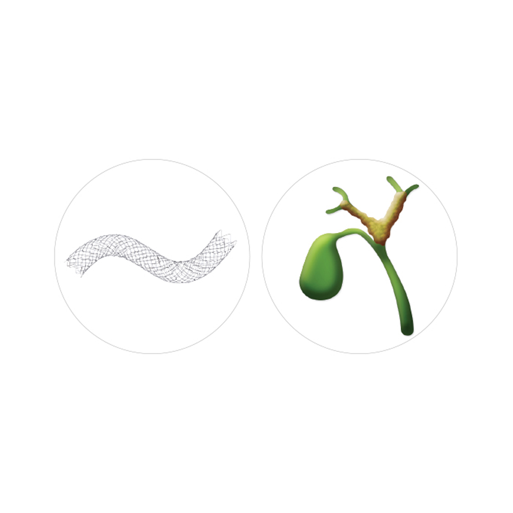 Niti-S Biliary Uncovered Stent [M-Type]