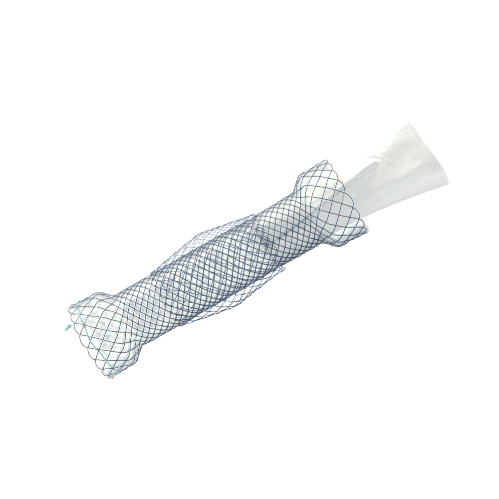 Niti-S Esophageal Covered Stent [Double-Type]Anti-reflux