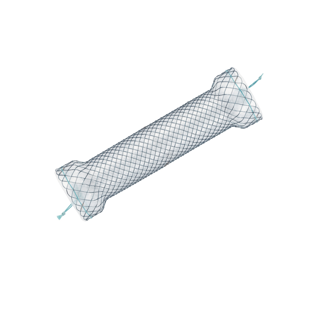 Niti-S Esophageal Covered Stent [S-Type]